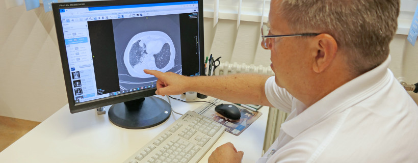Chefarzt Dr. med. Müller zeigt auf einer Röntgenaufnahme die Ausbreitung des Lungenkrebses.